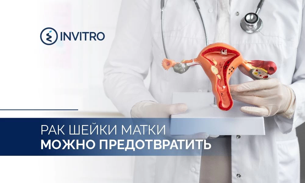 Всемирная неделя профилактики рака шейки матки