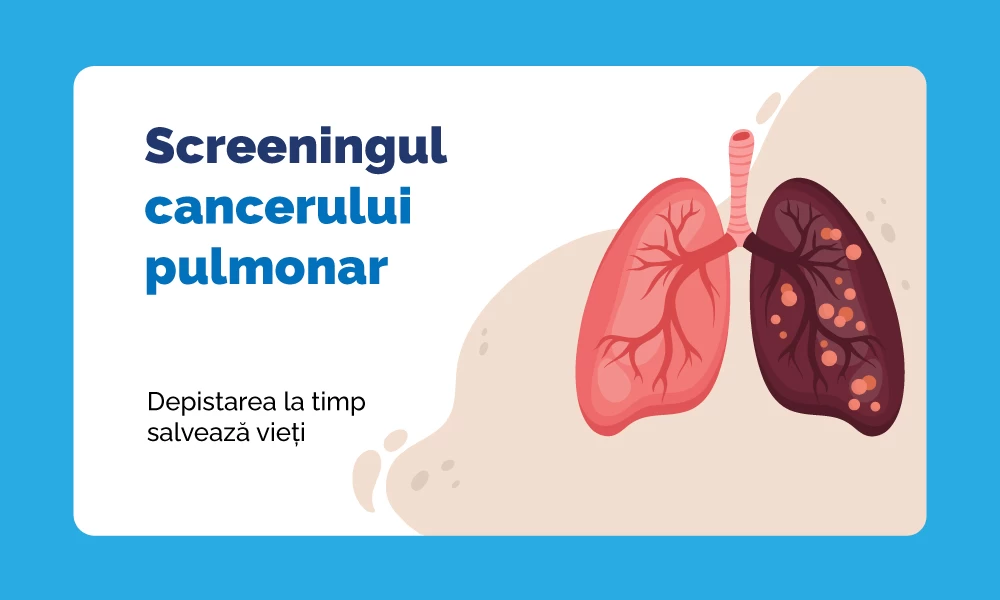Screeningul cancerului pulmonar