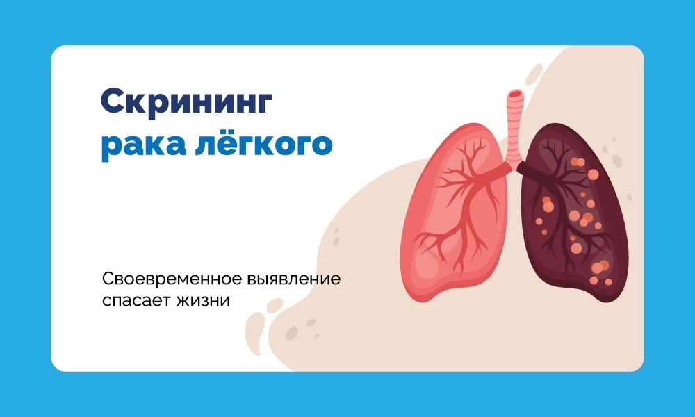 Скрининг рака лёгкого