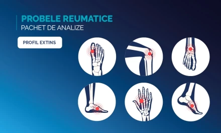 Probele reumatice, extins